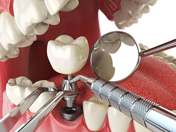 Best Orthodontic Emergency Dentist in Crestwood Village, NJ